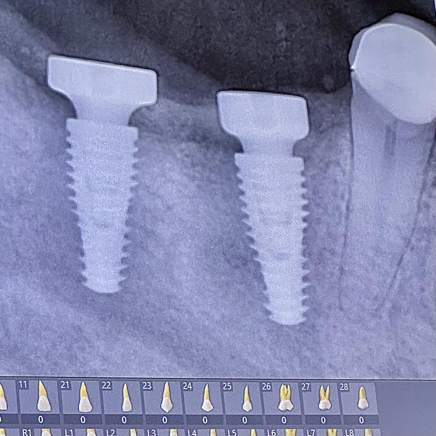 Click image for larger version

Name:	BE850D38-1629-45A5-AAF9-80EBC0619902.jpeg
Views:	86
Size:	127.6 KB
ID:	28338