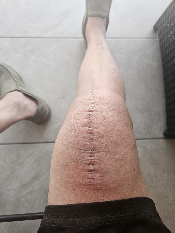 Click image for larger version

Name:	20240516_110601.jpg
Views:	100
Size:	55.4 KB
ID:	31154