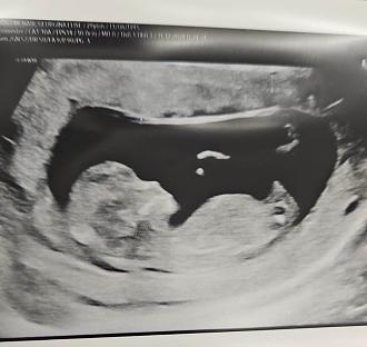 Click image for larger version  Name:	IMG-20241231-WA0001.jpg Views:	0 Size:	78.5 KB ID:	32269